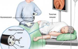 Колоноскопия кишечника: важные аспекты и рекомендации