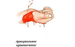 Первая помощь при артериальном кровотечении: важные рекомендации и советы