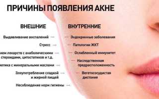 Причины появления и современные подходы в лечении акне у подростков