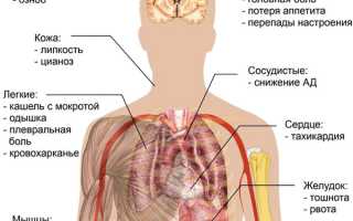 Симптомы пневмонии: как определить заболевание ещё до её начала и предотвратить осложнения?