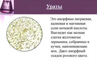 Повышение уровня мочевой кислоты в крови: норма, причины и симптомы заболевания