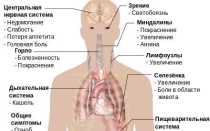 Плазматическая клетка