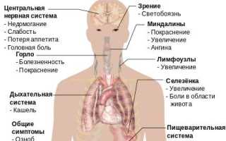 Плазматическая клетка