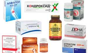 4 типа препаратов, восстанавливающие суставы для здоровья и активности