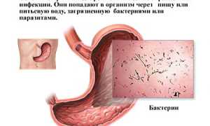 Диарея: причины и лечение у взрослых