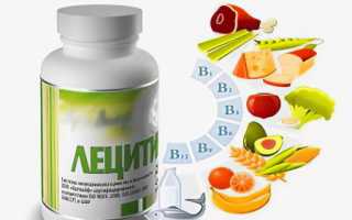 4 самых необходимых продукта при атеросклерозе для здоровья