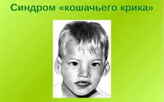 Синдром кошачьего крика: причины и последствия