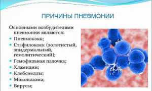 Пневмония без температуры: бывает ли и как отличить? Полезные советы