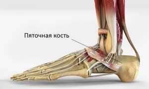 Болит пятка, больно наступать: причины и лечение, советы специалистов