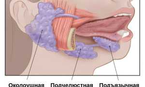 Сиалоаденит: причины, симптомы и лечение заболевания слюнных желез