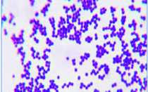 Staphylococcus haemolyticus норма у мужчин