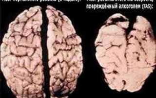 Прерывание и вывод из запоя на дому: эффективные методы и советы