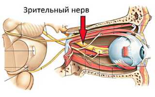 Неврит зрительного нерва: причины и симптомы