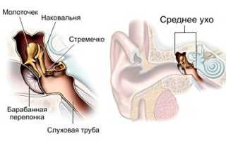Причины, симптомы и лечение воспаления среднего уха у детей и взрослых