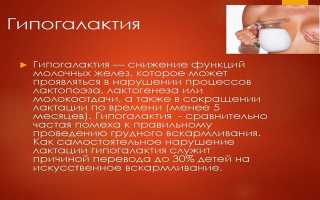Гипогалактия клинические рекомендации